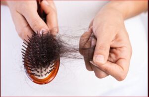 Hair Fall: